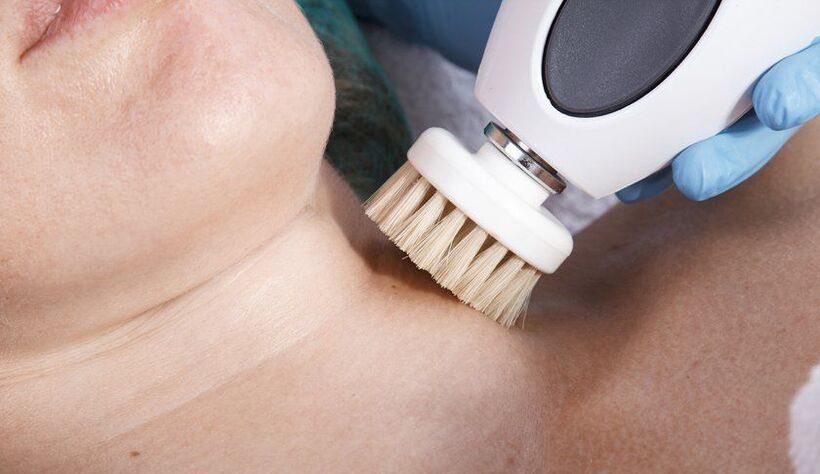 Cuello de cuello