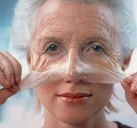 Rejuvenecimiento de la piel facial con un láser